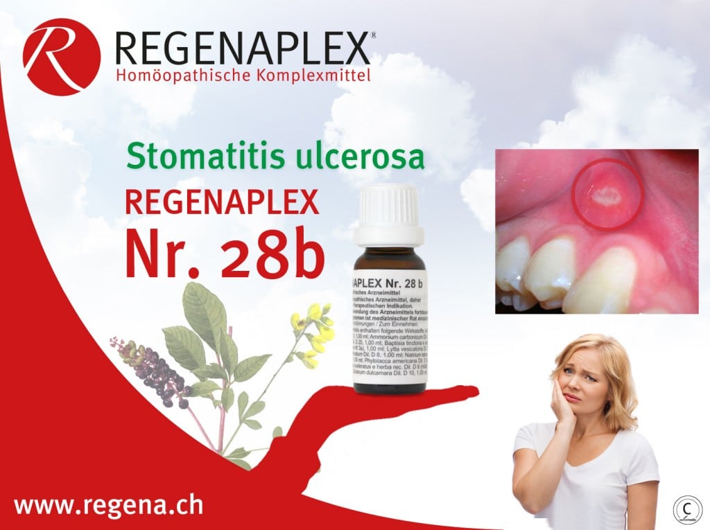 REGENAPLEX Nr 28b - Stomatitis ulcerosa